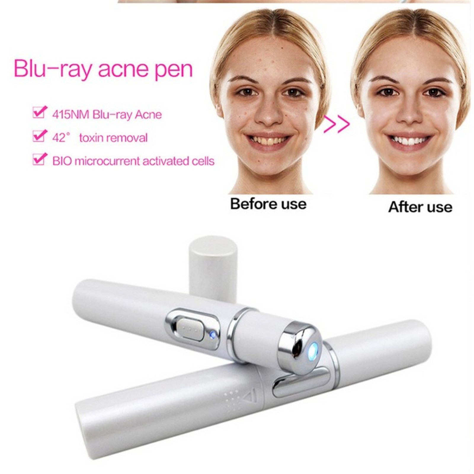 Blue Light Therapy Acne Laser Pen Soft Scar Wrinkle Removal Treatment Device Skin Care Beauty Equipment - الصورة 9