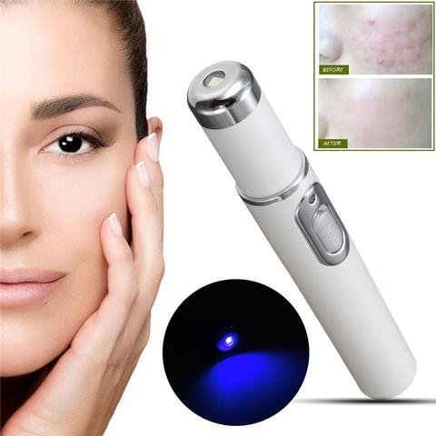 Blue Light Therapy Acne Laser Pen Soft Scar Wrinkle Removal Treatment Device Skin Care Beauty Equipment - الصورة 10
